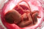 مقصر روزانه بیش از ۱۰۰۰ سقط جنین در کشور کیست؟!